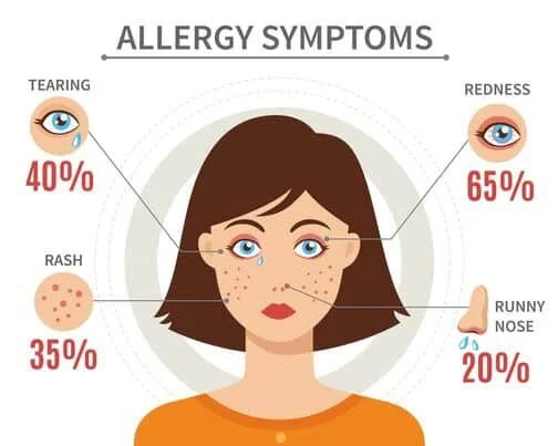 Allergy Symptoms